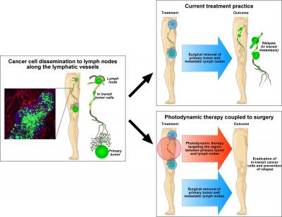 Targeting Intralymphatic Tumor Cells with photodynamic therapy